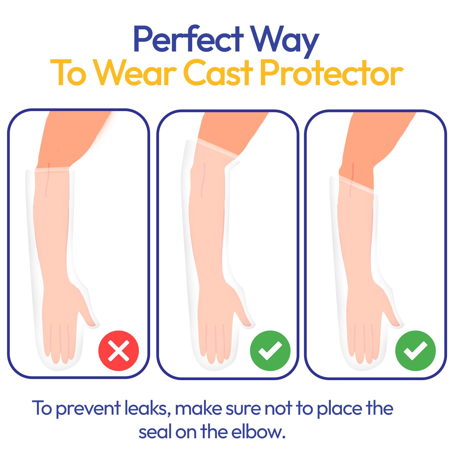 ALLAY Waterproof Cast Cover