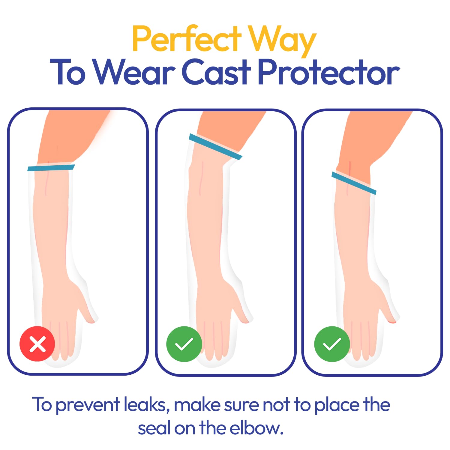 ALLAY Waterproof Cast Cover